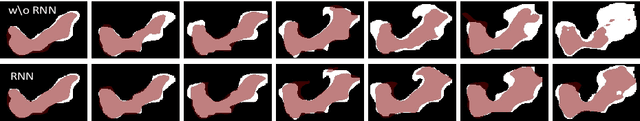 Figure 3 for Improving Deep Pancreas Segmentation in CT and MRI Images via Recurrent Neural Contextual Learning and Direct Loss Function