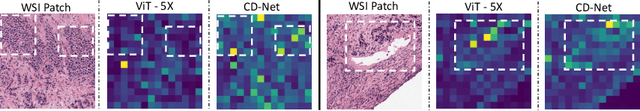 Figure 4 for CD-Net: Histopathology Representation Learning using Pyramidal Context-Detail Network