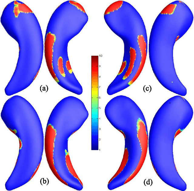 Figure 3 for Developing Univariate Neurodegeneration Biomarkers with Low-Rank and Sparse Subspace Decomposition