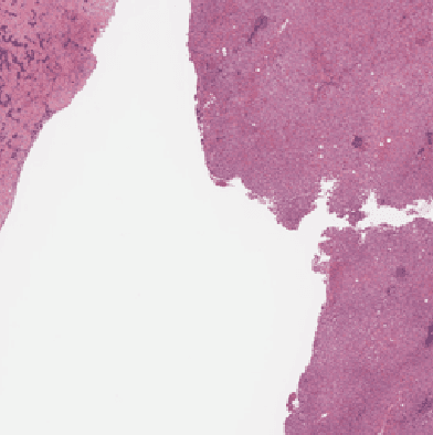 Figure 3 for Selecting Regions of Interest in Large Multi-Scale Images for Cancer Pathology