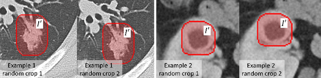 Figure 4 for Weakly-Supervised Universal Lesion Segmentation with Regional Level Set Loss