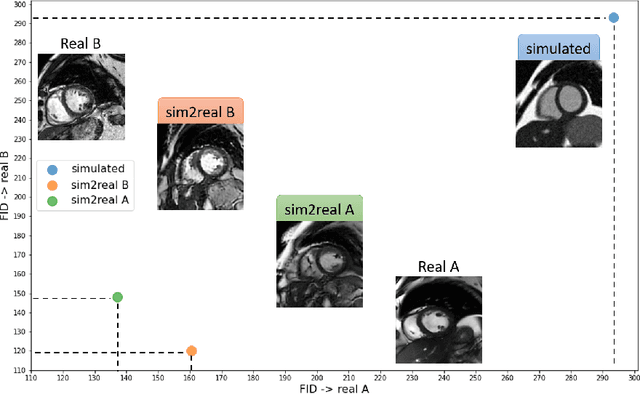 Figure 4 for sim2real: Cardiac MR Image Simulation-to-Real Translation via Unsupervised GANs