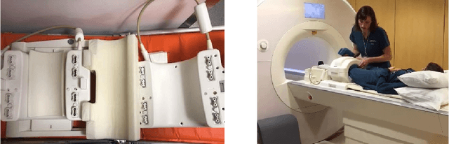 Figure 1 for fastMRI: An Open Dataset and Benchmarks for Accelerated MRI