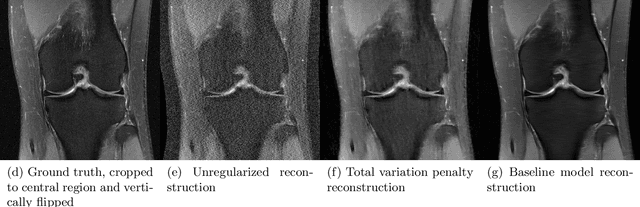 Figure 3 for fastMRI: An Open Dataset and Benchmarks for Accelerated MRI