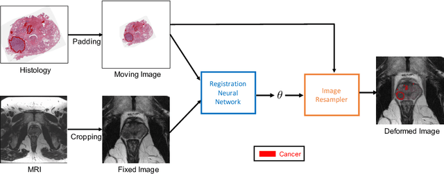 Figure 1 for Weakly Supervised Registration of Prostate MRI and Histopathology Images