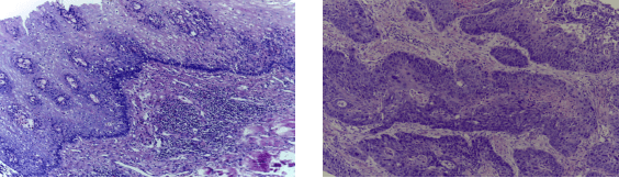 Figure 1 for Transfer Learning for Oral Cancer Detection using Microscopic Images