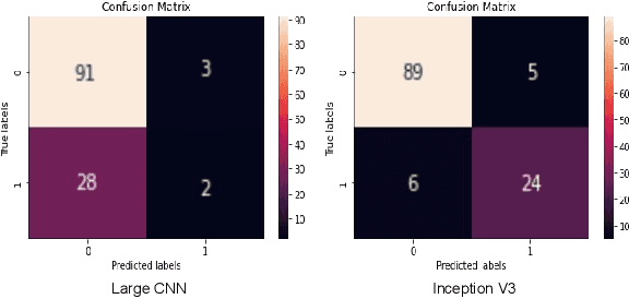 Figure 4 for Transfer Learning for Oral Cancer Detection using Microscopic Images