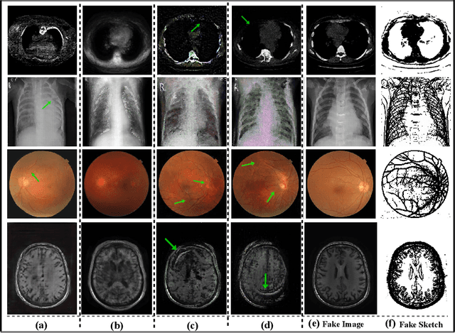 Figure 4 for SkrGAN: Sketching-rendering Unconditional Generative Adversarial Networks for Medical Image Synthesis