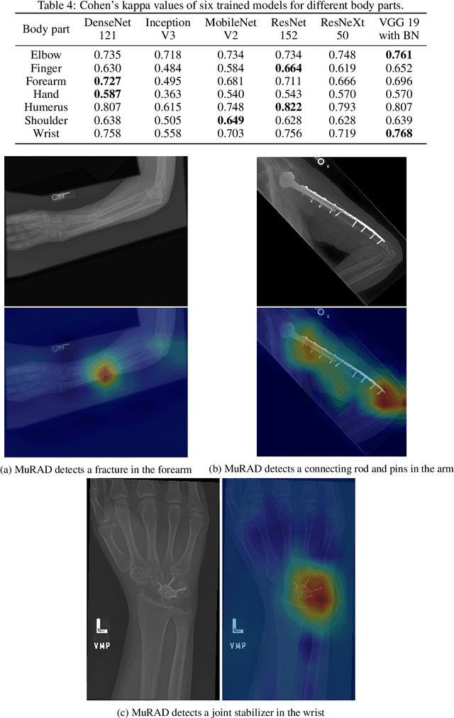 Figure 4 for Automating Abnormality Detection in Musculoskeletal Radiographs through Deep Learning