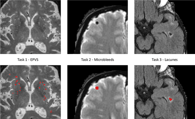 Figure 1 for Where is VALDO? VAscular Lesions Detection and segmentatiOn challenge at MICCAI 2021