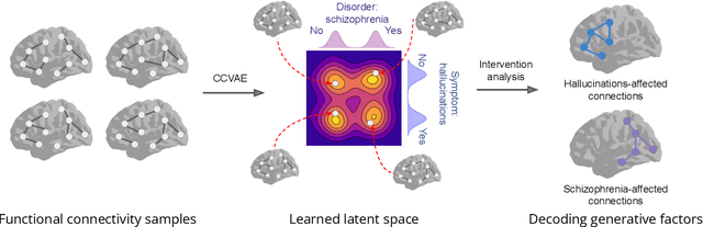 Figure 1 for Learning Generative Factors of Neuroimaging Data with Variational auto-encoders