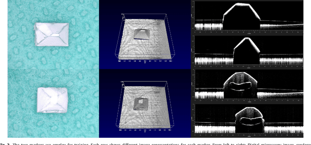 Figure 3 for A Deep Learning Approach for Pose Estimation from Volumetric OCT Data