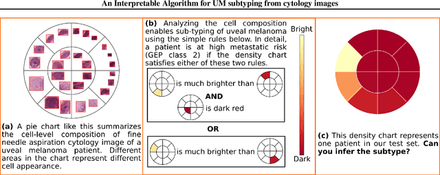 Figure 1 for An Interpretable Algorithm for Uveal Melanoma Subtyping from Whole Slide Cytology Images