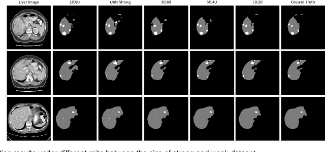 Figure 3 for A Teacher-Student Framework for Semi-supervised Medical Image Segmentation From Mixed Supervision