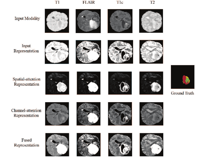 Figure 2 for Latent Correlation Representation Learning for Brain Tumor Segmentation with Missing MRI Modalities