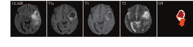Figure 1 for Latent Correlation Representation Learning for Brain Tumor Segmentation with Missing MRI Modalities