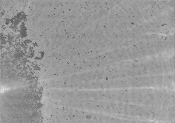 Figure 3 for Using Capsule Neural Network to predict Tuberculosis in lens-free microscopic images