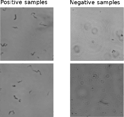 Figure 4 for Using Capsule Neural Network to predict Tuberculosis in lens-free microscopic images