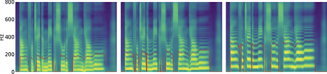 Figure 3 for MR-SVS: Singing Voice Synthesis with Multi-Reference Encoder