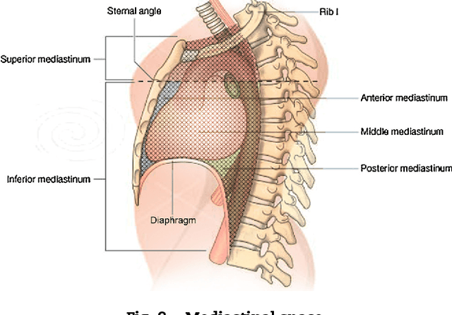 Figure 3 for A novel approach for the automated segmentation and volume quantification of cardiac fats on computed tomography