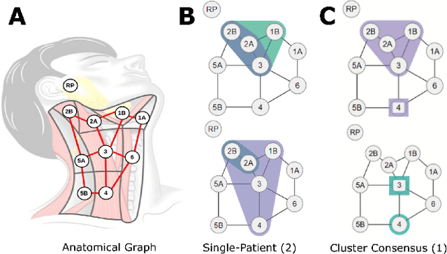Figure 1 for Explainable Spatial Clustering: Leveraging Spatial Data in Radiation Oncology