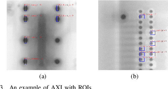 Figure 3 for Deep Learning Based Defect Detection for Solder Joints on Industrial X-Ray Circuit Board Images