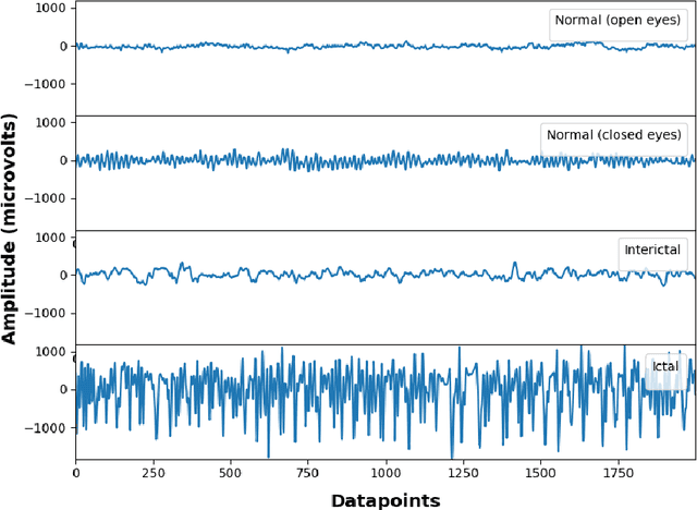 Figure 1 for Binary and Multiclass Classifiers based on Multitaper Spectral Features for Epilepsy Detection