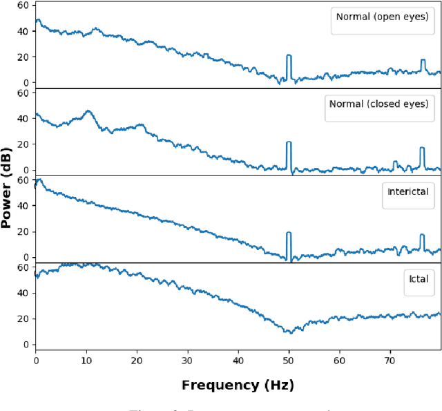 Figure 2 for Binary and Multiclass Classifiers based on Multitaper Spectral Features for Epilepsy Detection