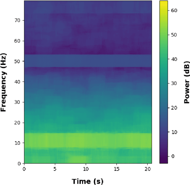 Figure 3 for Binary and Multiclass Classifiers based on Multitaper Spectral Features for Epilepsy Detection