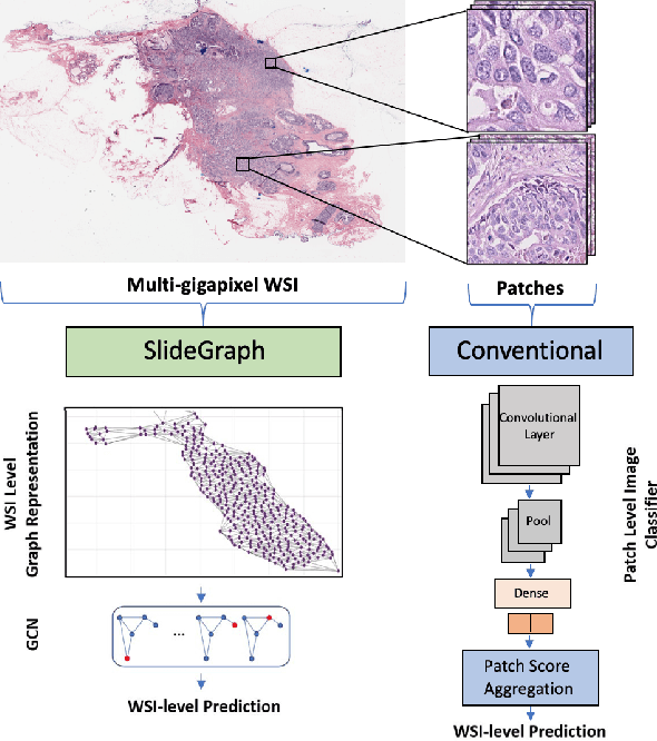Figure 3 for SlideGraph+: Whole Slide Image Level Graphs to Predict HER2Status in Breast Cancer