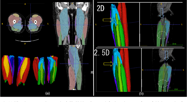 Figure 4 for Semantic Segmentation of Thigh Muscle using 2.5D Deep Learning Network Trained with Limited Datasets