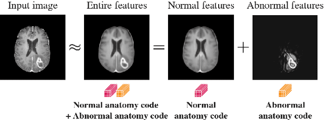 Figure 1 for Decomposing Normal and Abnormal Features of Medical Images into Discrete Latent Codes for Content-Based Image Retrieval