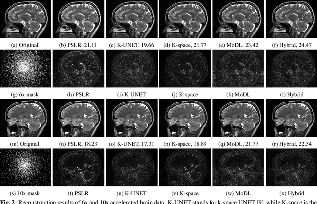 Figure 3 for Calibrationless Parallel MRI using Model based Deep Learning (C-MODL)