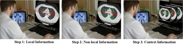 Figure 1 for RIDnet: Radiologist-Inspired Deep Neural Network for Low-dose CT Denoising