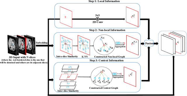 Figure 3 for RIDnet: Radiologist-Inspired Deep Neural Network for Low-dose CT Denoising