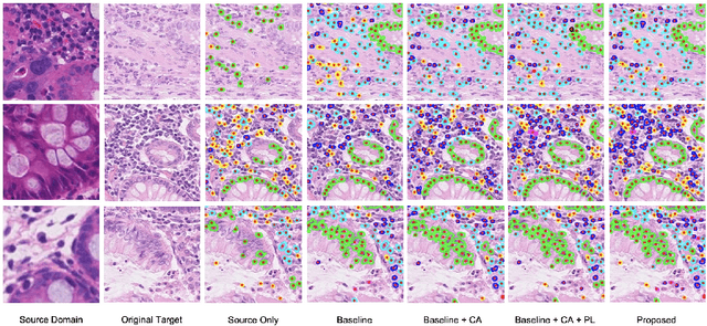 Figure 4 for Domain Adaptive Nuclei Instance Segmentation and Classification via Category-aware Feature Alignment and Pseudo-labelling