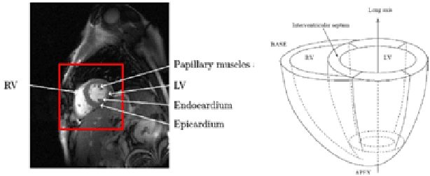 Figure 2 for Cardiac MR Image Segmentation Techniques: an overview