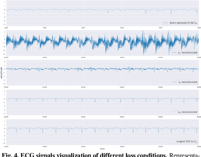 Figure 4 for ECG Signal Super-resolution by Considering Reconstruction and Cardiac Arrhythmias Classification Loss