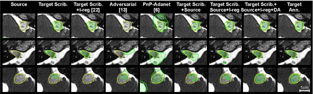 Figure 4 for Scribble-based Domain Adaptation via Co-segmentation