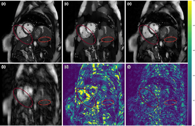 Figure 4 for A Deep Cascade of Convolutional Neural Networks for MR Image Reconstruction