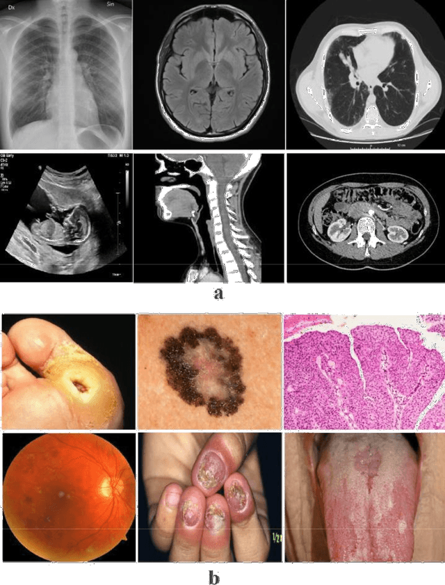 Figure 2 for MedNet: Pre-trained Convolutional Neural Network Model for the Medical Imaging Tasks