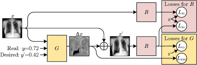 Figure 1 for Adversarial regression training for visualizing the progression of chronic obstructive pulmonary disease with chest x-rays