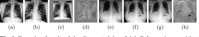 Figure 3 for Adversarial regression training for visualizing the progression of chronic obstructive pulmonary disease with chest x-rays