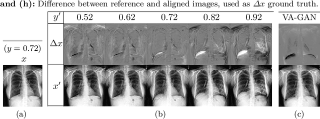Figure 4 for Adversarial regression training for visualizing the progression of chronic obstructive pulmonary disease with chest x-rays