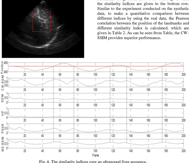 Figure 4 for Full-reference image quality assessment-based B-mode ultrasound image similarity measure
