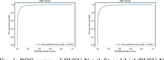 Figure 1 for BUSU-Net: An Ensemble U-Net Framework for Medical Image Segmentation