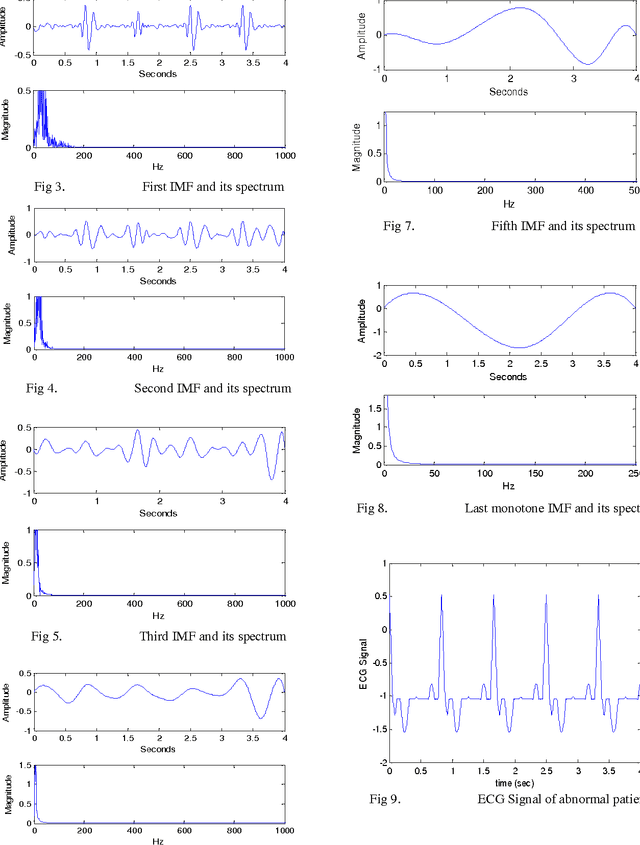 Figure 2 for Feature Extraction of ECG Signal Using HHT Algorithm