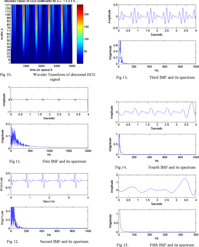 Figure 3 for Feature Extraction of ECG Signal Using HHT Algorithm