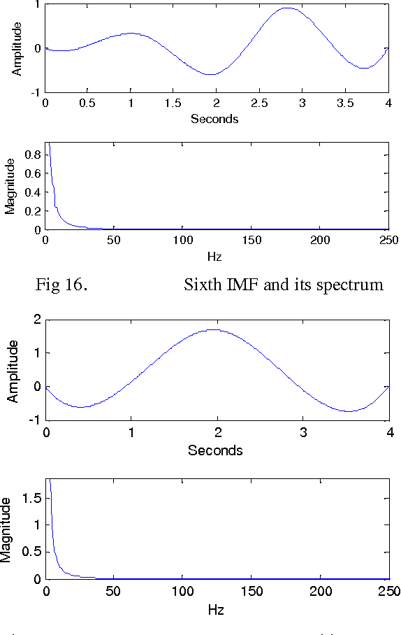 Figure 4 for Feature Extraction of ECG Signal Using HHT Algorithm
