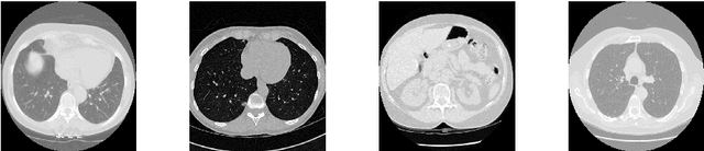 Figure 3 for A Deep Convolutional Neural Network for Lung Cancer Diagnostic